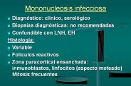 Mononucleosis infecciosa