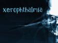 Xerophthalmia PowerPoint PPT Presentation