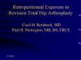 Retroperitoneal Exposure in Revision Total Hip Arthroplasty  Cecil H. Rorabeck, MD Paul H. Partington, MB, BS, FRCS PowerPoint PPT Presentation