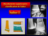 Aucun titre de diapositive