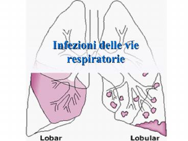 Infezioni delle vie respiratorie