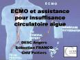 ECMO et assistance pour insuffisance circulatoire aigue PowerPoint PPT Presentation