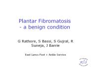 Plantar Fibromatosis - a benign condition