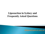 Liposuction in Sydney and Frequently Asked Questions