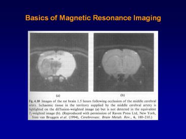 Basics of Magnetic Resonance Imaging