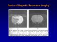 Basics of Magnetic Resonance Imaging PowerPoint PPT Presentation