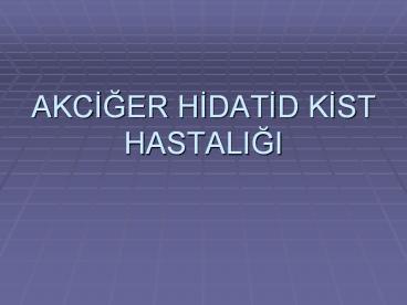 AKCIGER HIDATID KIST HASTALIGI