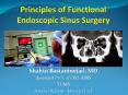 Principles of Functional Endoscopic Sinus Surgery PowerPoint PPT Presentation