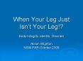 When Your Leg Just Isn PowerPoint PPT Presentation