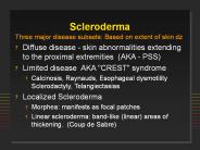 Scleroderma