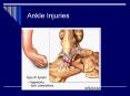 Ankle Injuries PowerPoint PPT Presentation