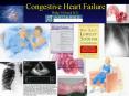 Congestive Heart Failure Philip D Houck M.D. PowerPoint PPT Presentation