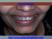 Deland dentist
