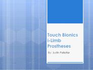 Touch%20Bionics%20i-Limb%20Prostheses