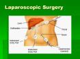 Laparoscopy in Bangalore,  Laparoscopic Surgeon Bangalore PowerPoint PPT Presentation