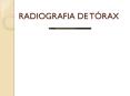 RADIOGRAFIA DE T PowerPoint PPT Presentation