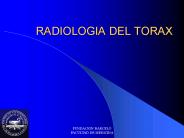 RADIOLOGIA DEL TORAX