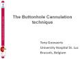 The Buttonhole Cannulation technique PowerPoint PPT Presentation