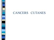 CANCERS  CUTANES