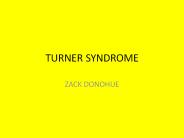 TURNER SYNDROME