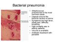 Bacterial pneumonia PowerPoint PPT Presentation