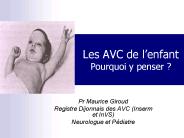 Les AVC de l