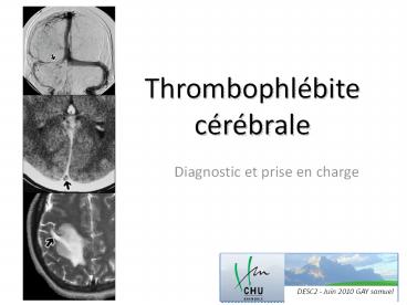 Diagnostic et prise en charge
