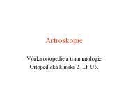 Artroskopie