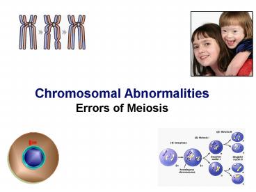 Chromosomal Abnormalities