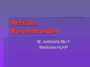 Artritis Reumato