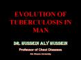 EVOLUTION OF TUBERCULOSIS IN MAN PowerPoint PPT Presentation