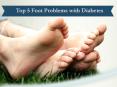 Foot Problems with Diabetes PowerPoint PPT Presentation
