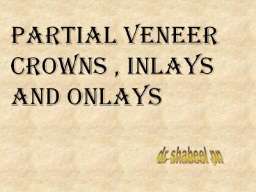 Partial Veneer Crowns , Inlays and Onlays