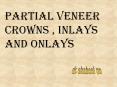 Partial Veneer Crowns , Inlays and Onlays PowerPoint PPT Presentation