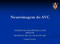 Neuroimagem do AVC PowerPoint PPT Presentation
