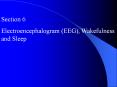 Electroencephalogram (EEG), Wakefulness and Sleep PowerPoint PPT Presentation