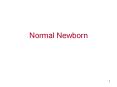 Normal Newborn PowerPoint PPT Presentation