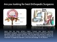 Are you looking for Best Orthopedic Surgeons PowerPoint PPT Presentation