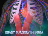 Surgery in India | India Heart Surgery