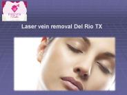 Laser vein removal Del Rio TX
