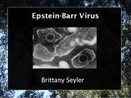 Epstein-Barr Virus