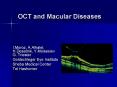 OCT and Macular Diseases PowerPoint PPT Presentation