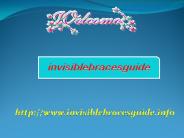 Invisalign Braces