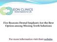Five Reasons Dental Implants Are the Best Option among Missing Teeth Solutions PowerPoint PPT Presentation