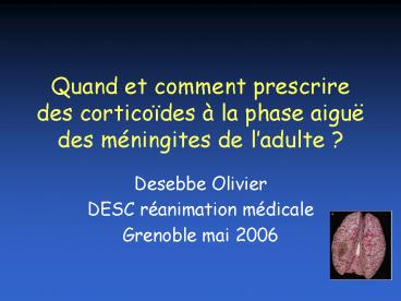 Quand et comment prescrire des cortico