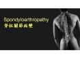 Spondyloarthropathy ?????? PowerPoint PPT Presentation