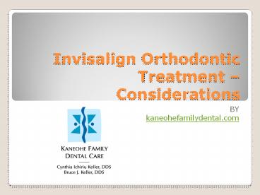 Invisalign Orthodontic Treatment – Considerations