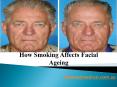 How Smoking Affects Facial Ageing PowerPoint PPT Presentation