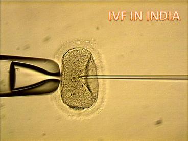 IVF in India a Boon for Infertile Couples