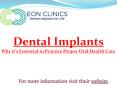 Dental Implants: Why it's Essential to Practice Proper Oral Health Care PowerPoint PPT Presentation